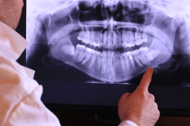 Best Emergency Broken Tooth Repair in Waynesboro, VA